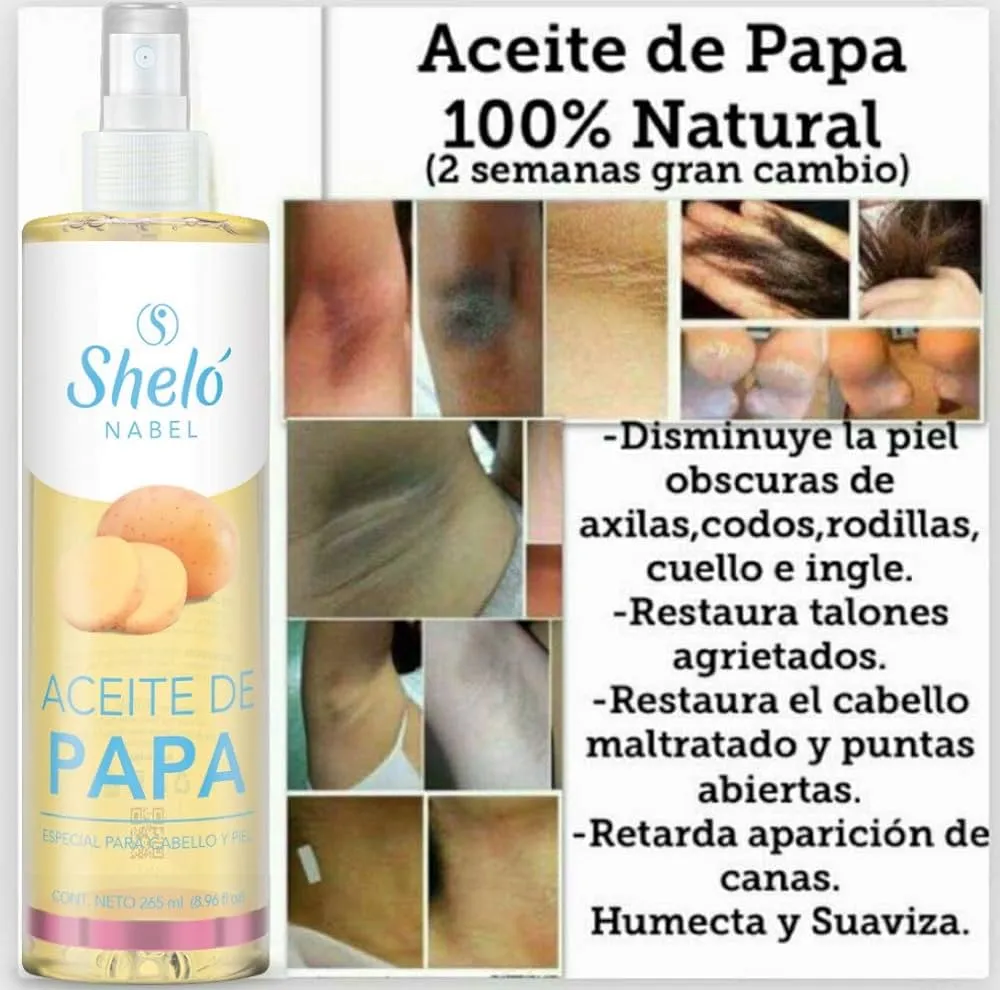 Aceite De Papa Shelo Nabel Como Se Usa Shelo Nabel